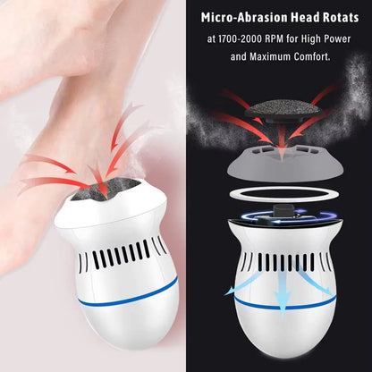 Amoladora eléctrica para pies, removedor de callos, limas recargables para pies, máquina de limpieza, herramientas para el cuidado de los pies, dispositivo exfoliante para pedicura